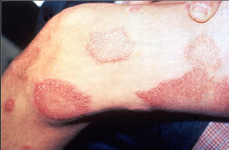 diseases of the skin #11